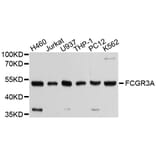 Western Blot - Anti-FCGR3A Antibody (A1441) - Antibodies.com