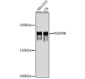 Western Blot - Anti-PDGFR beta Antibody (A8929) - Antibodies.com