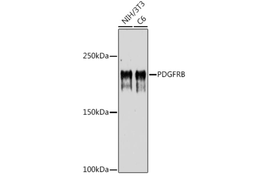 Western Blot - Anti-PDGFR beta Antibody (A8929) - Antibodies.com