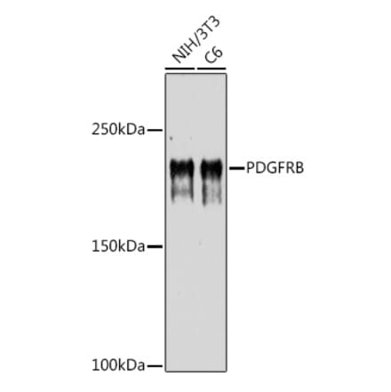 Western Blot - Anti-PDGFR beta Antibody (A8929) - Antibodies.com