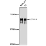 Western Blot - Anti-PDGFR beta Antibody (A8929) - Antibodies.com