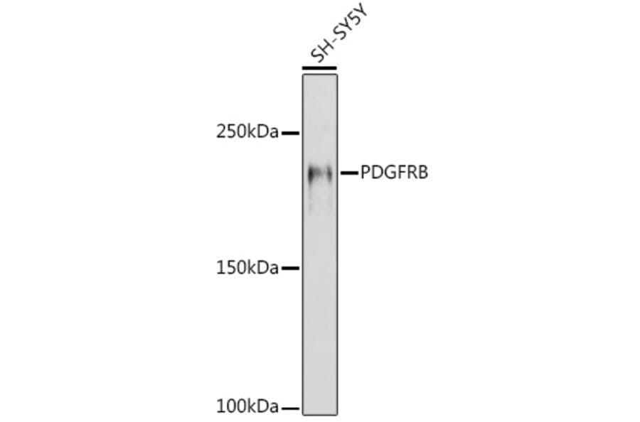 Western Blot - Anti-PDGFR beta Antibody (A8929) - Antibodies.com