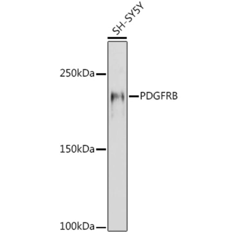 Western Blot - Anti-PDGFR beta Antibody (A8929) - Antibodies.com