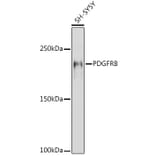 Western Blot - Anti-PDGFR beta Antibody (A8929) - Antibodies.com