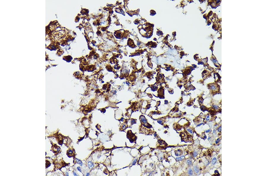 Immunohistochemistry - Anti-PDGFR beta Antibody (A8929) - Antibodies.com
