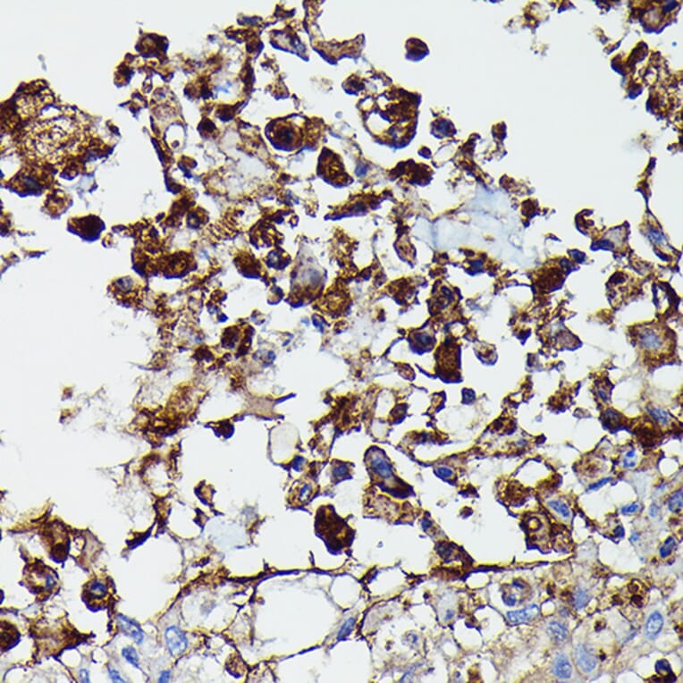 Immunohistochemistry - Anti-PDGFR beta Antibody (A8929) - Antibodies.com