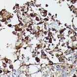 Immunohistochemistry - Anti-PDGFR beta Antibody (A8929) - Antibodies.com