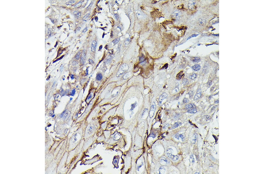Immunohistochemistry - Anti-PDGFR beta Antibody (A8929) - Antibodies.com