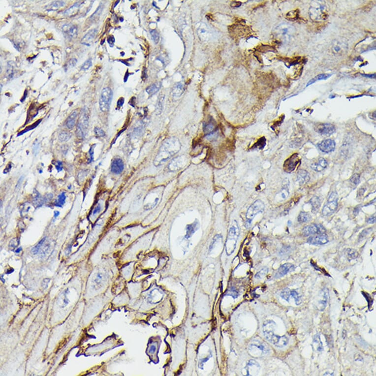Immunohistochemistry - Anti-PDGFR beta Antibody (A8929) - Antibodies.com
