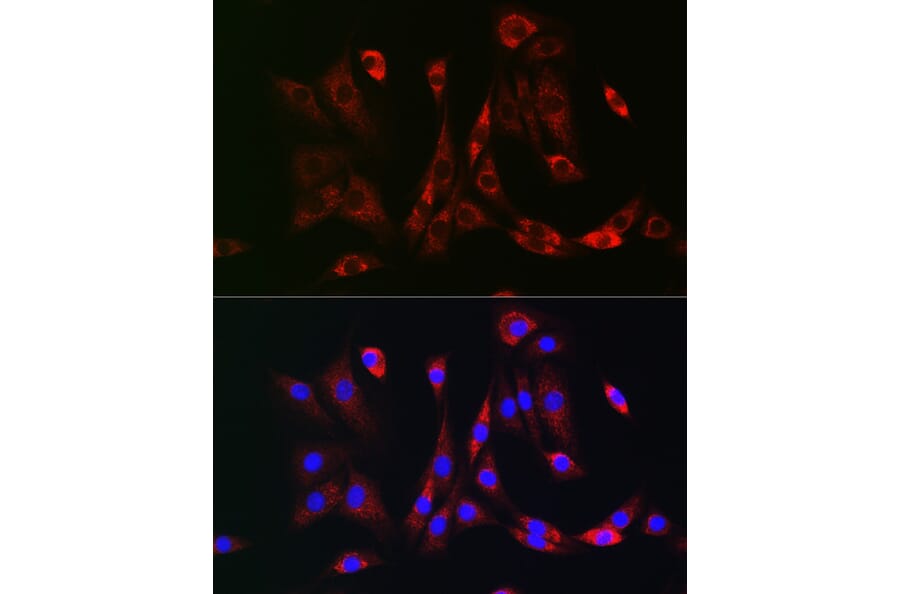 Immunofluorescence - Anti-PDGFR beta Antibody (A8929) - Antibodies.com