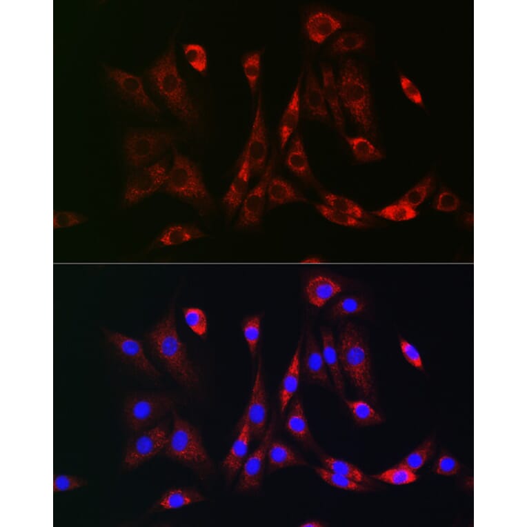 Immunofluorescence - Anti-PDGFR beta Antibody (A8929) - Antibodies.com