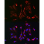 Immunofluorescence - Anti-PDGFR beta Antibody (A8929) - Antibodies.com