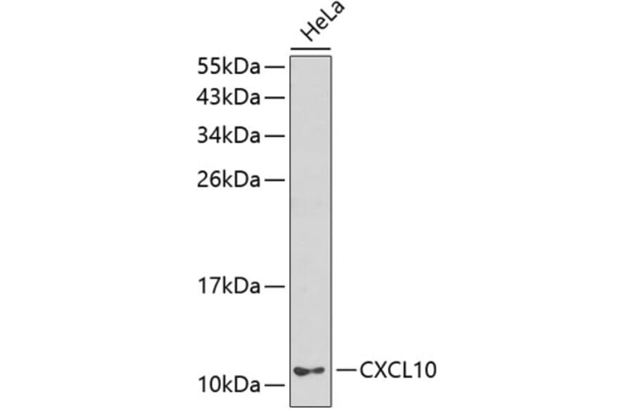 Western Blot - Anti-IP10 Antibody (A8930) - Antibodies.com