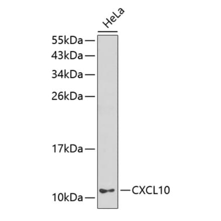 Western Blot - Anti-IP10 Antibody (A8930) - Antibodies.com
