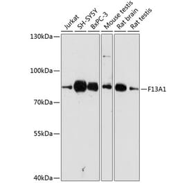 Western Blot - Anti-Factor XIIIa Antibody (A8931) - Antibodies.com