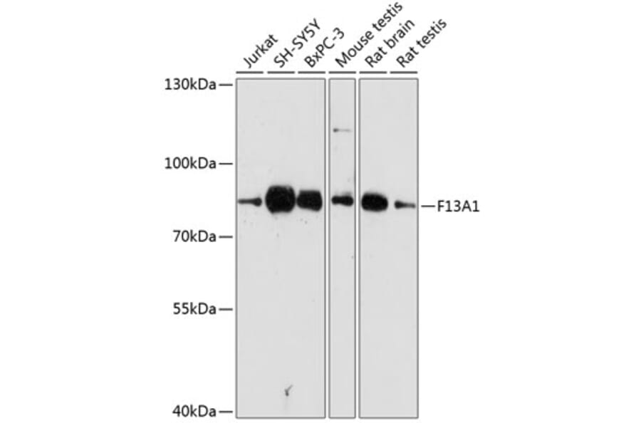 Western Blot - Anti-Factor XIIIa Antibody (A8931) - Antibodies.com