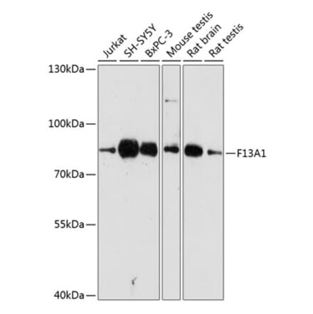 Western Blot - Anti-Factor XIIIa Antibody (A8931) - Antibodies.com
