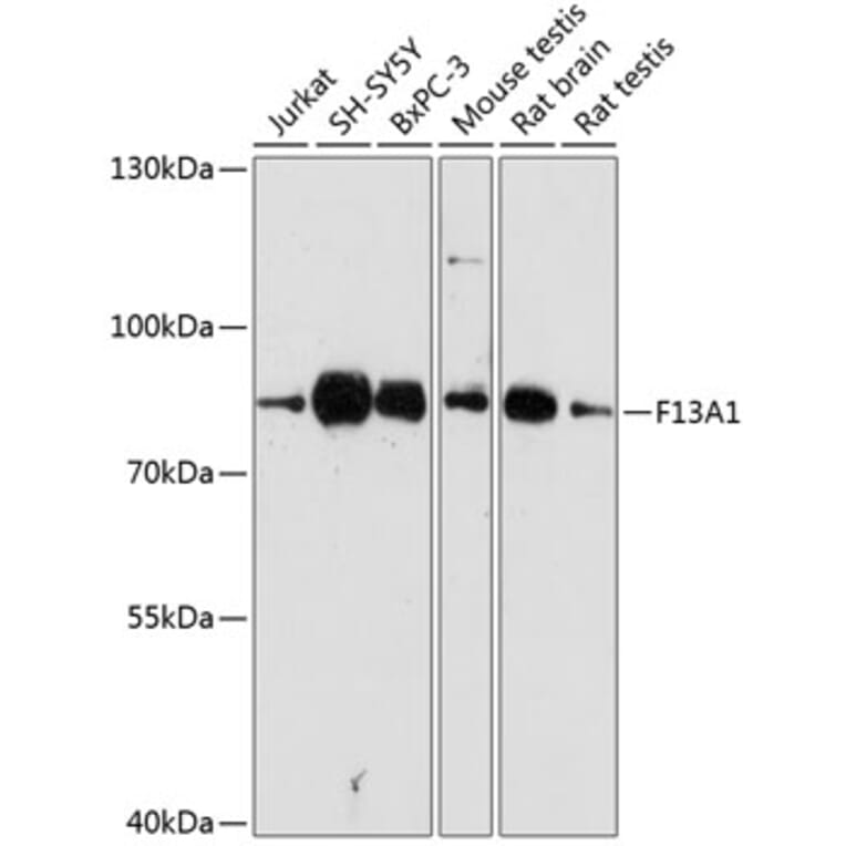 Western Blot - Anti-Factor XIIIa Antibody (A8931) - Antibodies.com