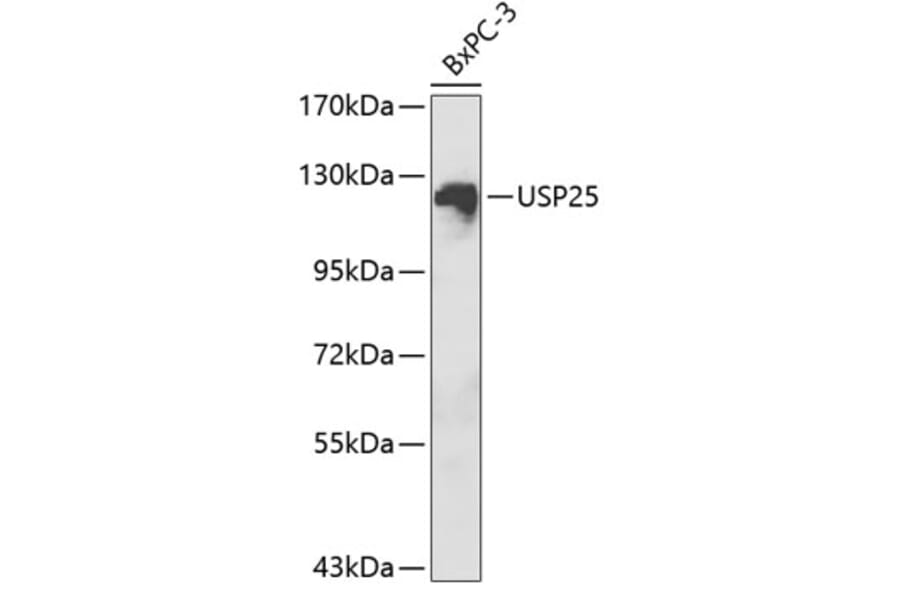 Western Blot - Anti-USP25 Antibody (A1477) - Antibodies.com