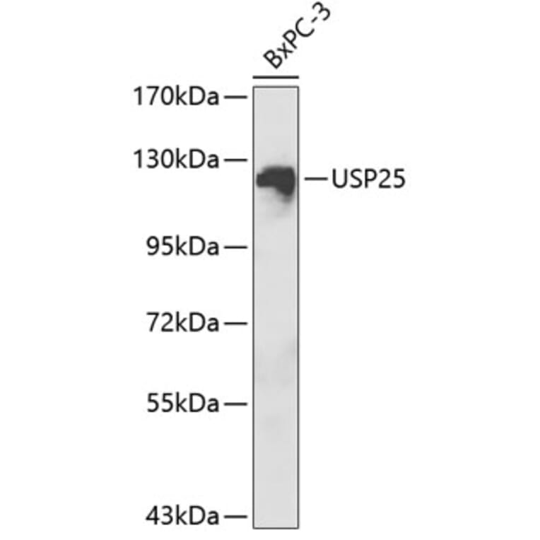 Western Blot - Anti-USP25 Antibody (A1477) - Antibodies.com