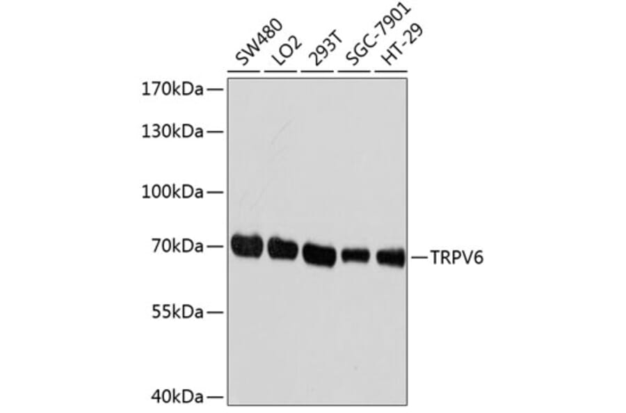 Western Blot - Anti-TRPV6 Antibody (A1495) - Antibodies.com