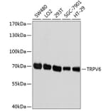 Western Blot - Anti-TRPV6 Antibody (A1495) - Antibodies.com