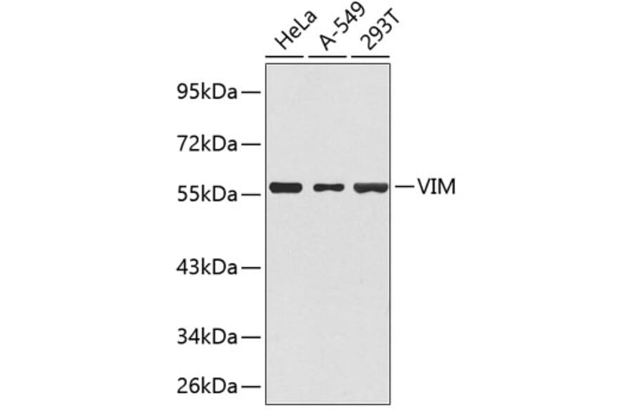 Western Blot - Anti-VIM Antibody (A1504) - Antibodies.com