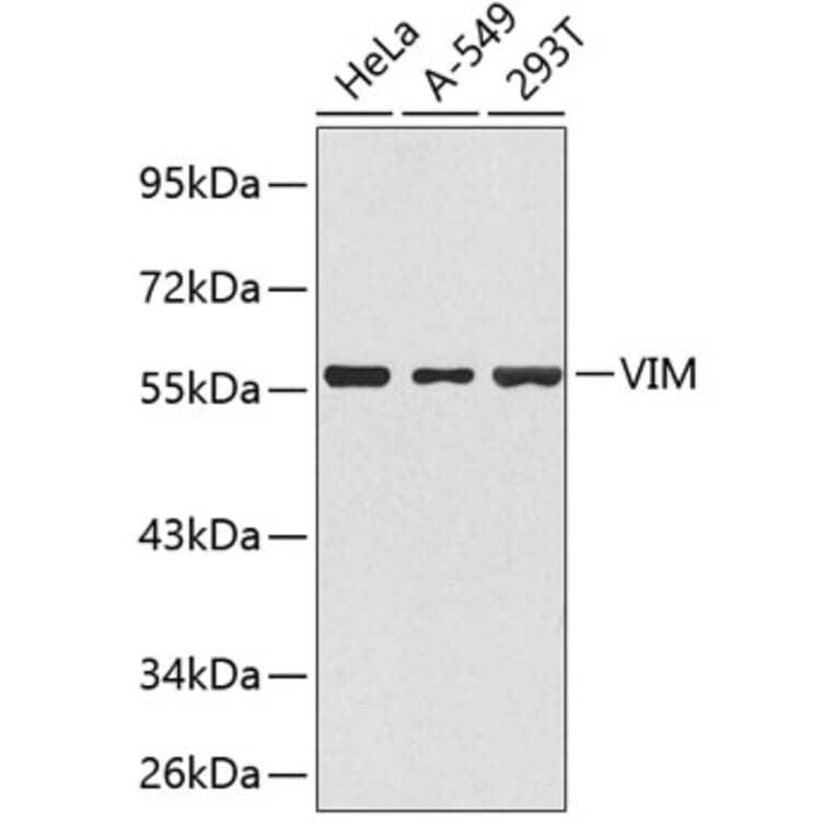 Western Blot - Anti-VIM Antibody (A1504) - Antibodies.com