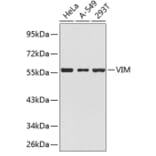 Western Blot - Anti-VIM Antibody (A1504) - Antibodies.com