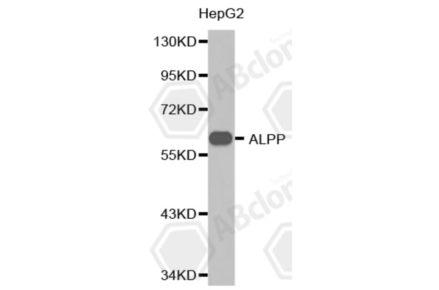 Western Blot - Anti-ALPP Antibody (A1529) - Antibodies.com