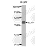 Western Blot - Anti-ALPP Antibody (A1529) - Antibodies.com