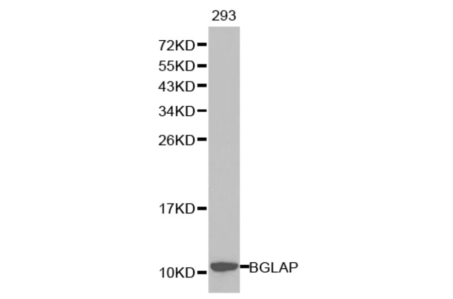 Western Blot - Anti-BGLAP Antibody (A1530) - Antibodies.com
