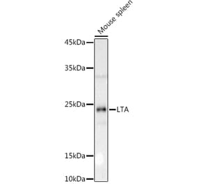 Western Blot - Anti-LTA Antibody (A8938) - Antibodies.com