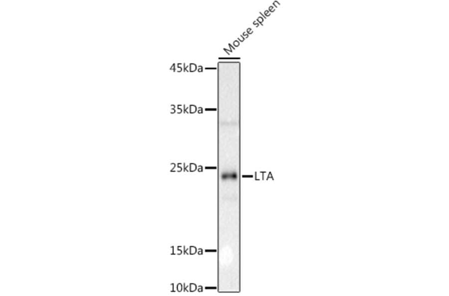 Western Blot - Anti-LTA Antibody (A8938) - Antibodies.com
