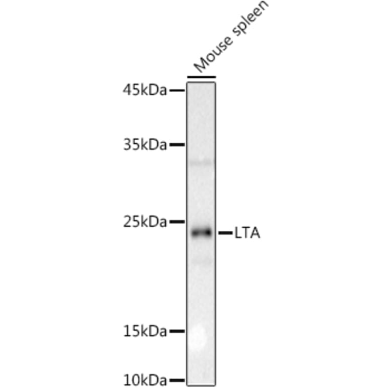 Western Blot - Anti-LTA Antibody (A8938) - Antibodies.com