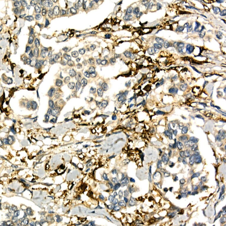 Immunohistochemistry - Anti-LTA Antibody (A8938) - Antibodies.com