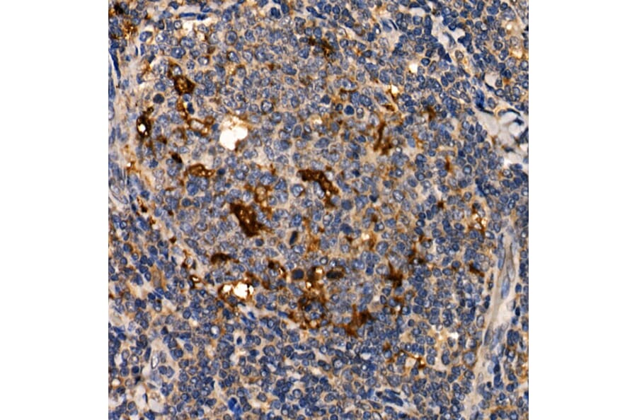 Immunohistochemistry - Anti-LTA Antibody (A8938) - Antibodies.com