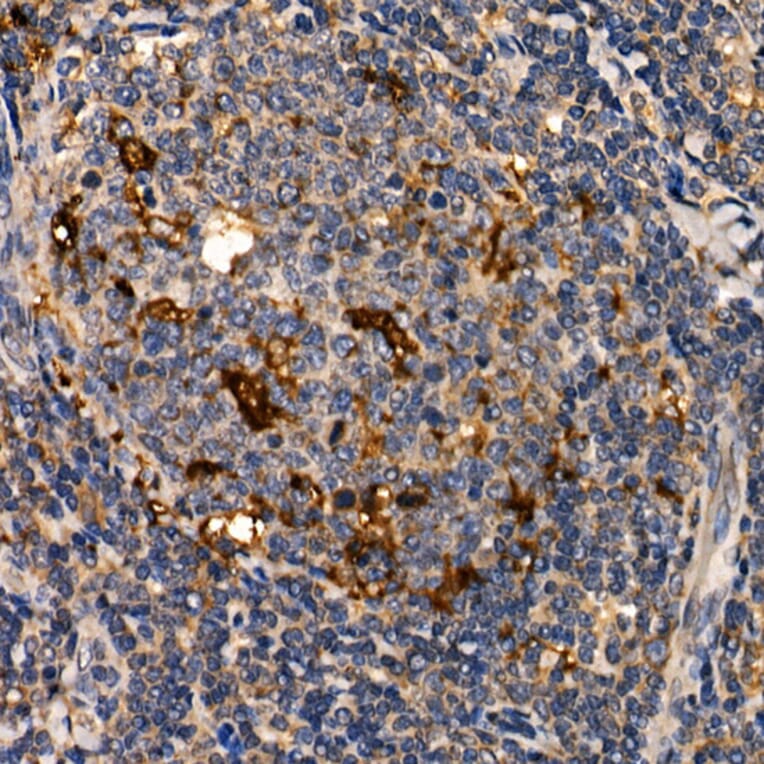 Immunohistochemistry - Anti-LTA Antibody (A8938) - Antibodies.com