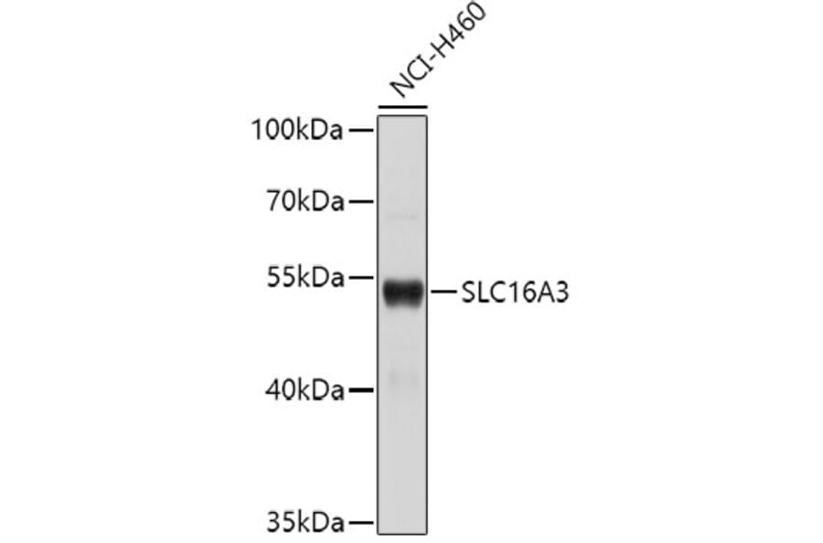 Western Blot - Anti-SLC16A3 Antibody (A1554) - Antibodies.com