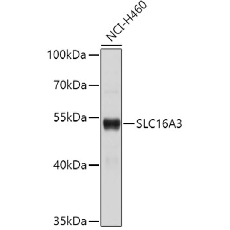 Western Blot - Anti-SLC16A3 Antibody (A1554) - Antibodies.com