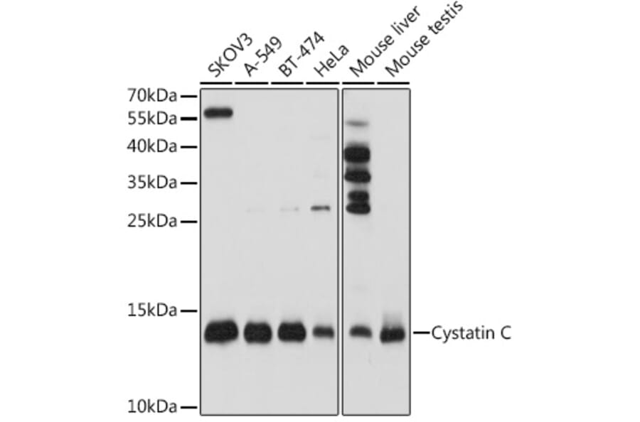 Western Blot - Anti-Cystatin C Antibody (A8940) - Antibodies.com