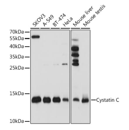 Western Blot - Anti-Cystatin C Antibody (A8940) - Antibodies.com