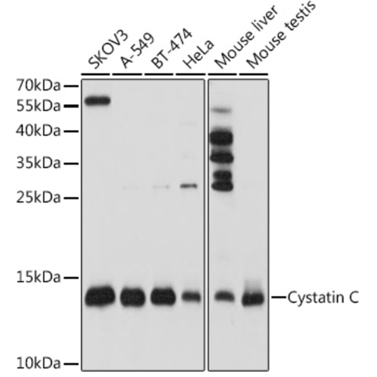 Western Blot - Anti-Cystatin C Antibody (A8940) - Antibodies.com