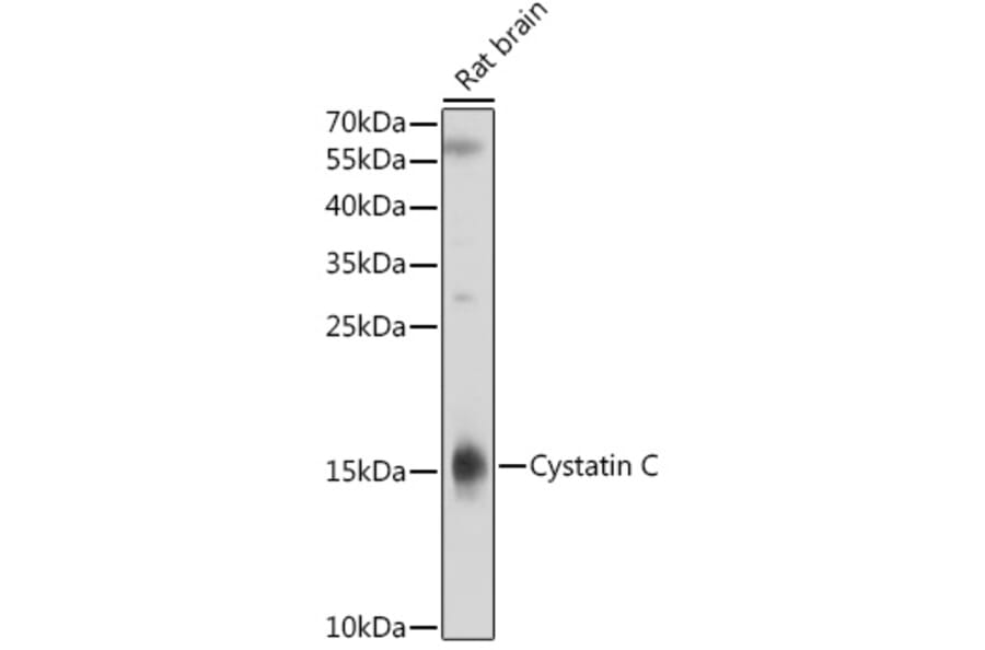 Western Blot - Anti-Cystatin C Antibody (A8940) - Antibodies.com