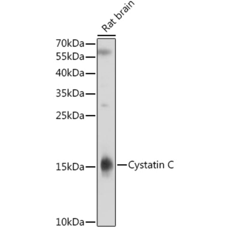 Western Blot - Anti-Cystatin C Antibody (A8940) - Antibodies.com