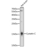 Western Blot - Anti-Cystatin C Antibody (A8940) - Antibodies.com