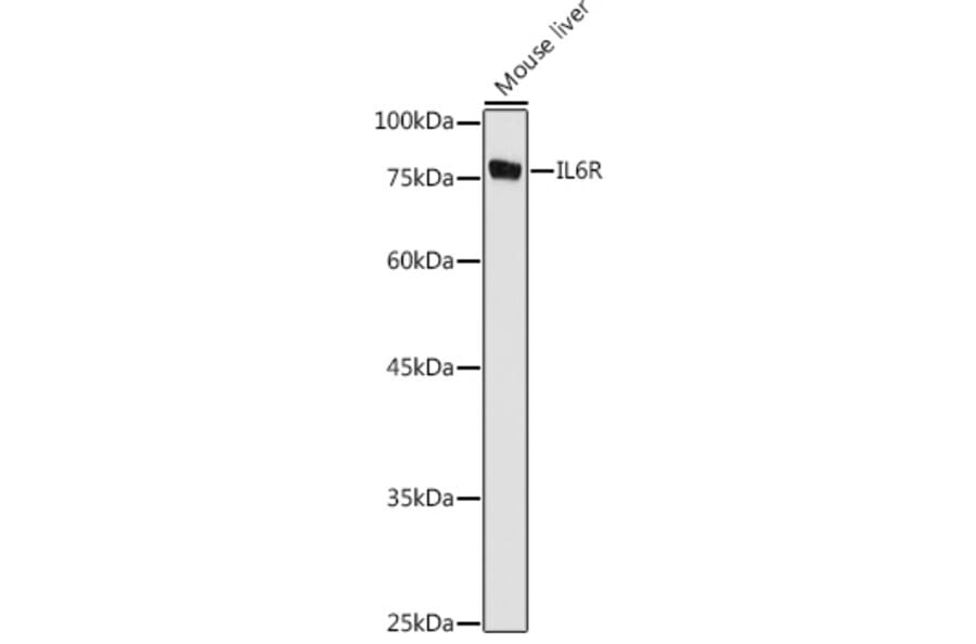 Western Blot - Anti-IL-6R Antibody (A8941) - Antibodies.com