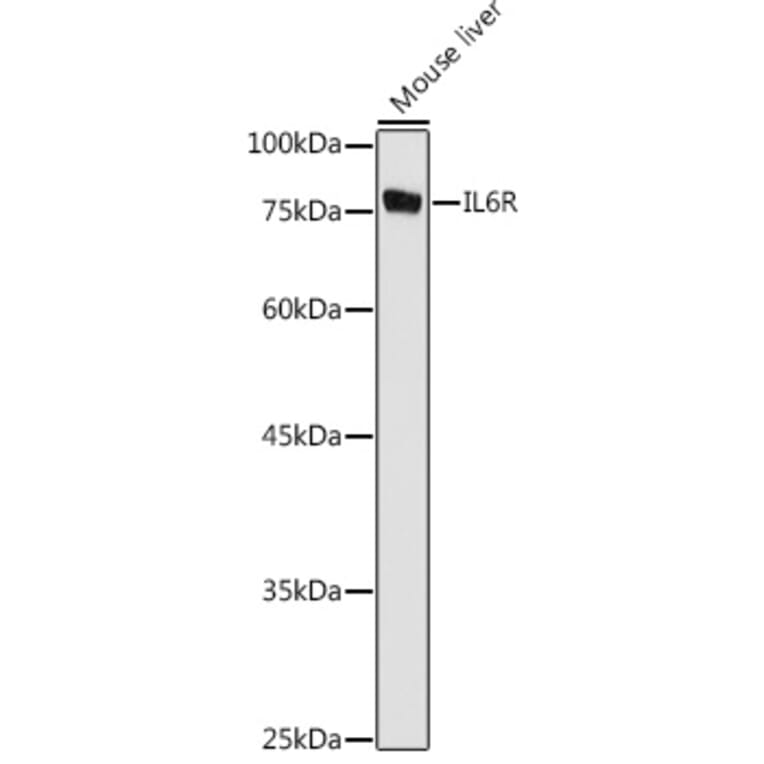 Western Blot - Anti-IL-6R Antibody (A8941) - Antibodies.com