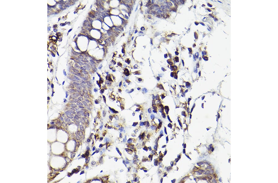 Immunohistochemistry - Anti-IL-6R Antibody (A8941) - Antibodies.com