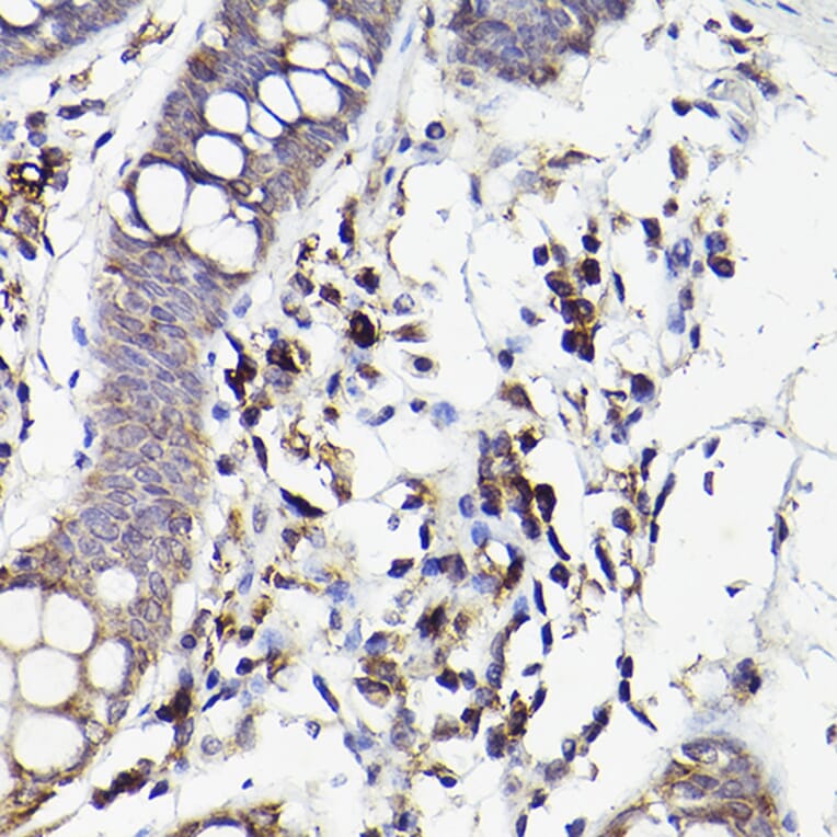 Immunohistochemistry - Anti-IL-6R Antibody (A8941) - Antibodies.com